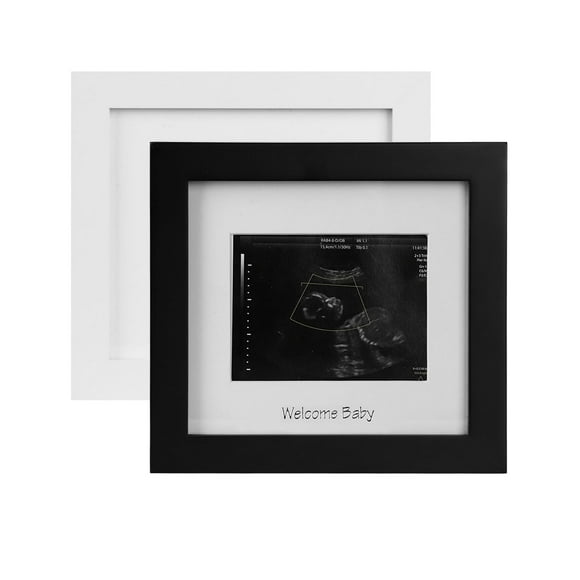 Marco de Fotos de Ultrasonido para Bebé IHEIPYE en Negro y Blanco con Texto Plateado