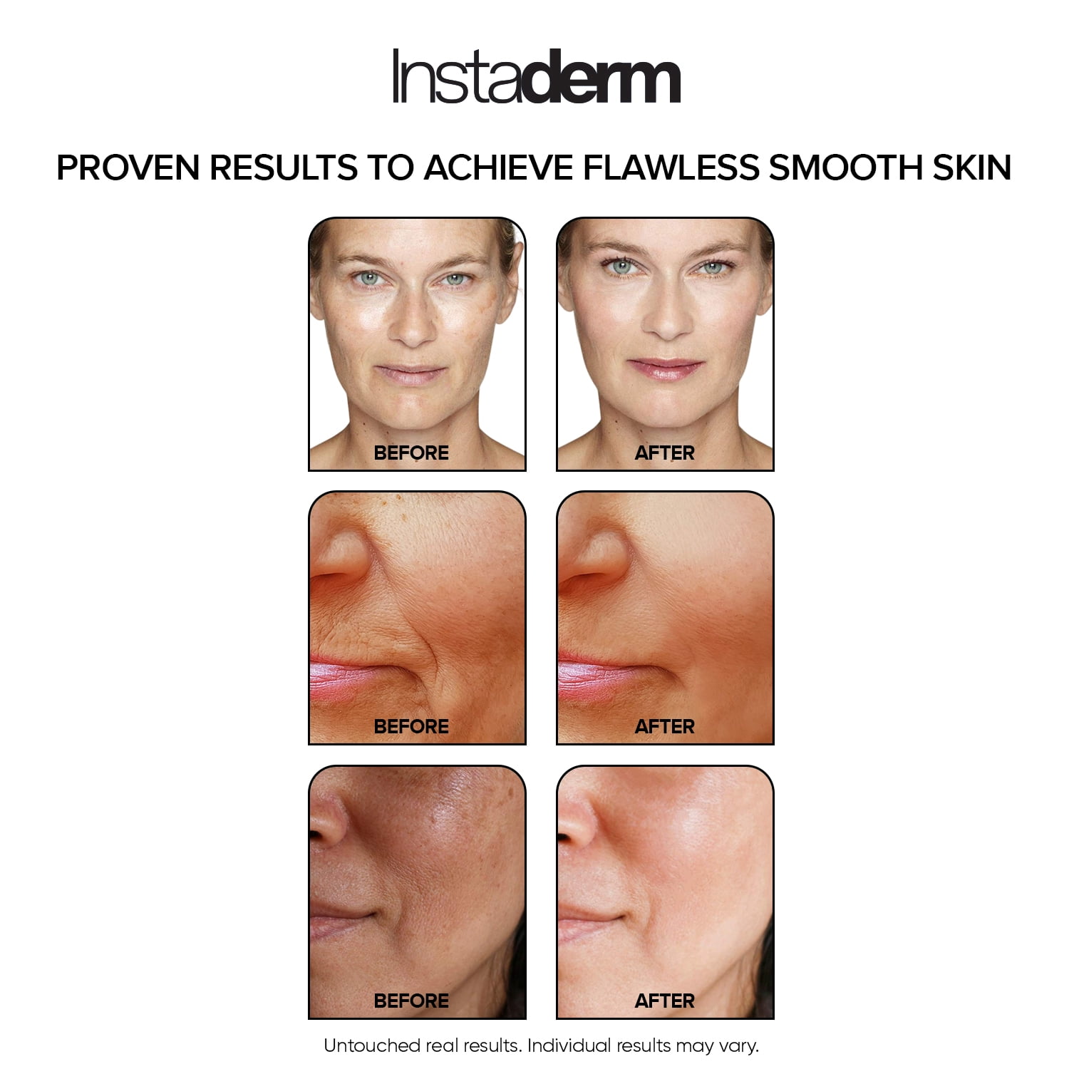 Retinol Skin Booster Cream- Age-Defying formula That Visibly Reduce The appearance of Fine Lines & Wrinkles. Improve Firmness, Elasticity, Thickness Of The Skin & Evens skin Tone.