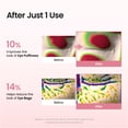 thumbnail image 5 of BIODANCE Collagen Peptide Eye Patches, Anti Wrinkle & Smile Line Patches for Face, Under Eye Mask for Fine Lines & Eye Bags, Travel Essentials & Self Care Gifts for Women, Korean Skin Care (60 Count), 5 of 9