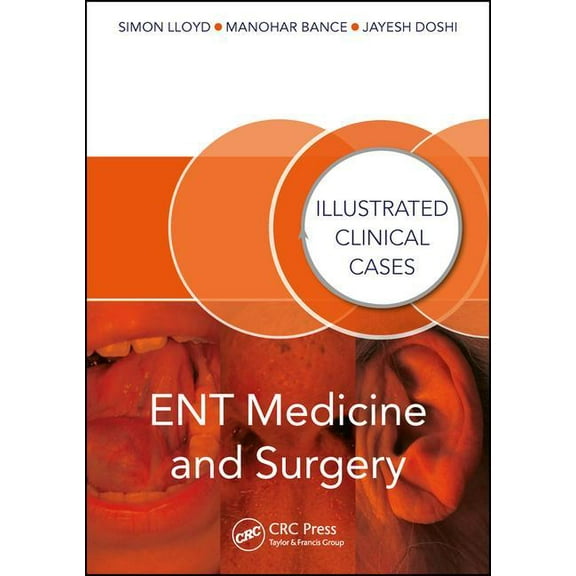Illustrated Clinical Cases: Ent Medicine and Surgery: Illustrated Clinical Cases (Paperback)