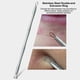 thumbnail image 5 of 3PCS Pimple Comedone Extractor Tool Kit de eliminación de acné Tratamiento para Labymos  Kit de eliminación de acné, 5 of 7