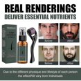 thumbnail image 4 of Natural Men's Beard Growth Roller Kit Men's Beard Growth Oil Nourishing Enhancer, 4 of 5