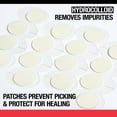 thumbnail image 5 of Neutrogena Stubborn Acne Pimple Patches, Hydrocolloid Patches Acne Treatment, 24 Count, 5 of 8