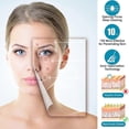 thumbnail image 2 of Facial Steamer Nano Ionic Spray Machine with 360 Rotating Arm - Portable Home & Salon Facial Vaporizer Hydrating Skincare Device, 2 of 5