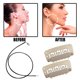 thumbnail image 3 of Abrazaderas En Forma De U Para Estiramiento Facial Y Ajuste Del Cuello, Herramientas De Modelado, Cinturón De Estiramiento Facial Y Facial En Forma De V 5 Pares Sweethay CE008259-02, 3 of 6