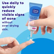 CLEAN & CLEAR ADVANTAGE Acne Spot Treatment Oil-Free 0.75 oz (Pack of 2)