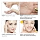 thumbnail image 2 of Cuidado eficaz de la piel facial Manchas de acné Eliminación de cicatrices Marcas 17 ml, 2 of 4