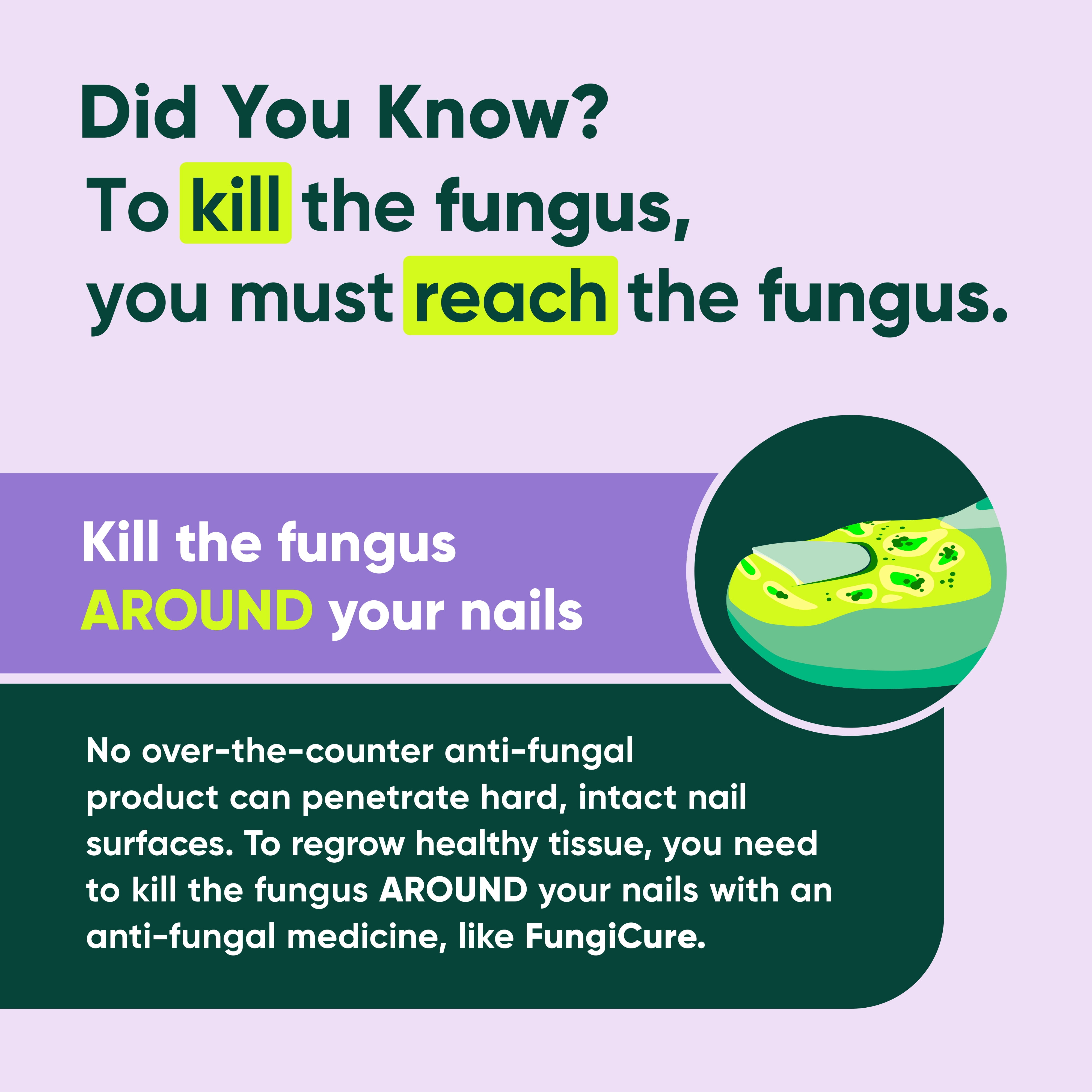 FungiCure Anti-Fungal Night Cream, Cures & Soothes, Clotrimazole 1%, 1.7 oz