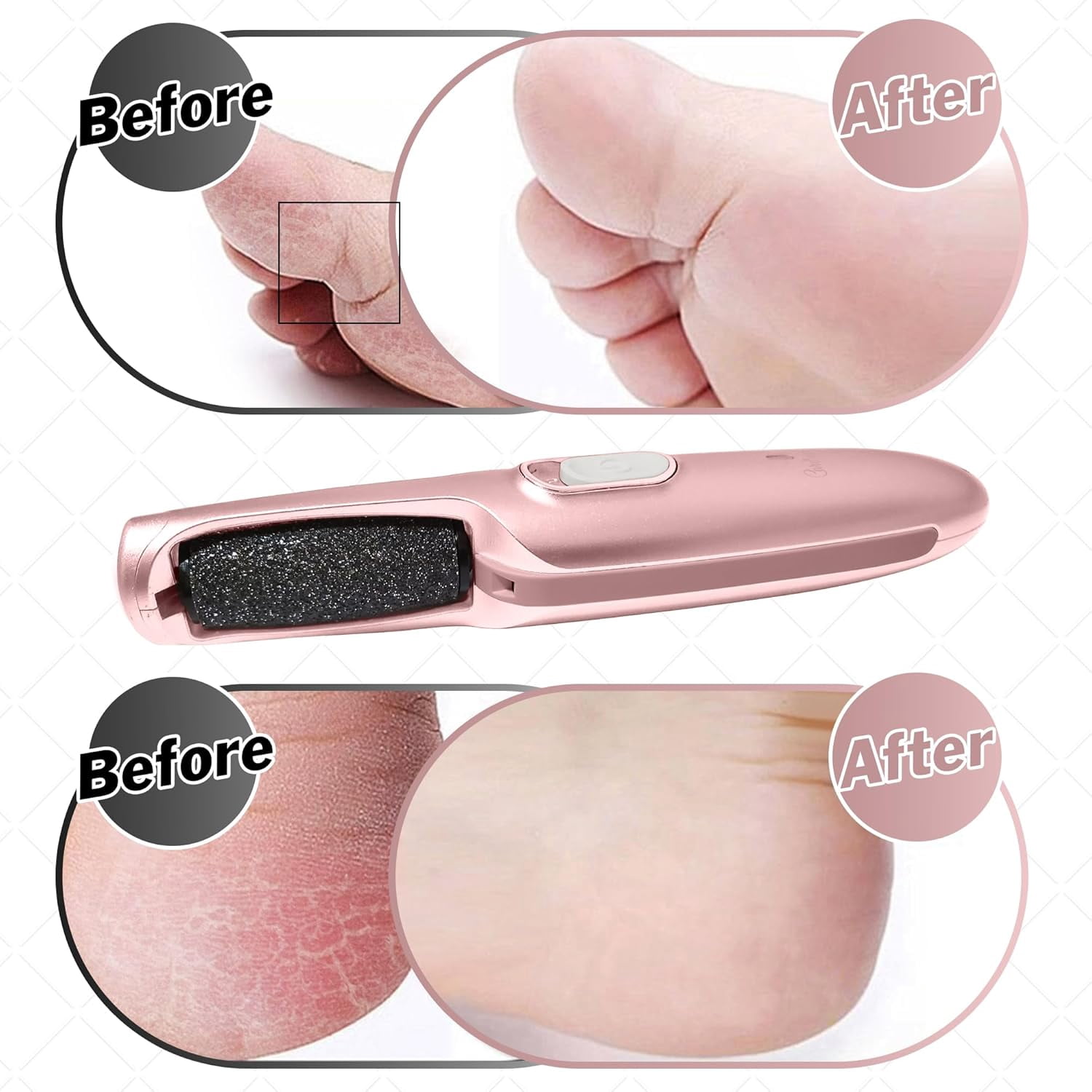 Care Me Powerful Electric Foot Callus File Removes Dry, Dead, Hard Skin, Callous for Pedicure Spa-like Smooth & Soft Feet