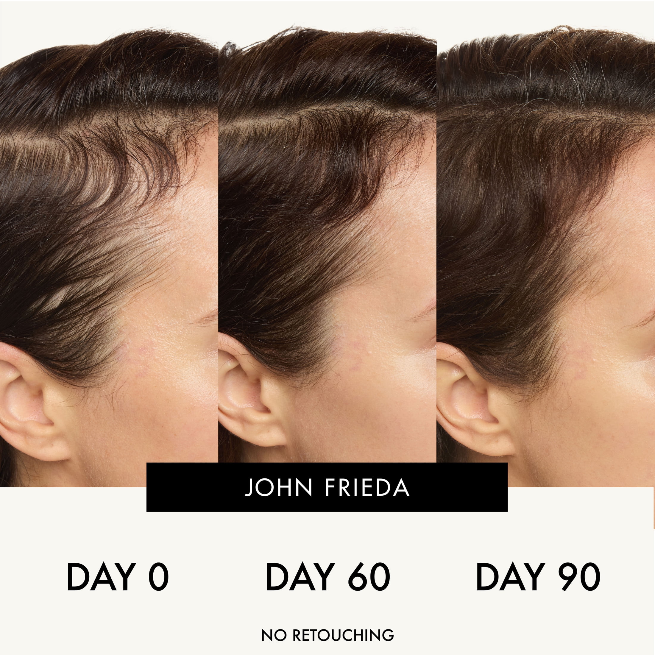 John Frieda ULTRAfiller+ Hair Density Scalp Serum, Hair Thickening Serum for Fine Hair, 2 fl oz