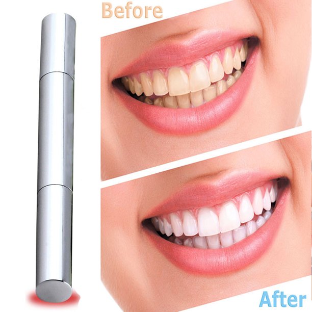 do teeth bleaching pens work