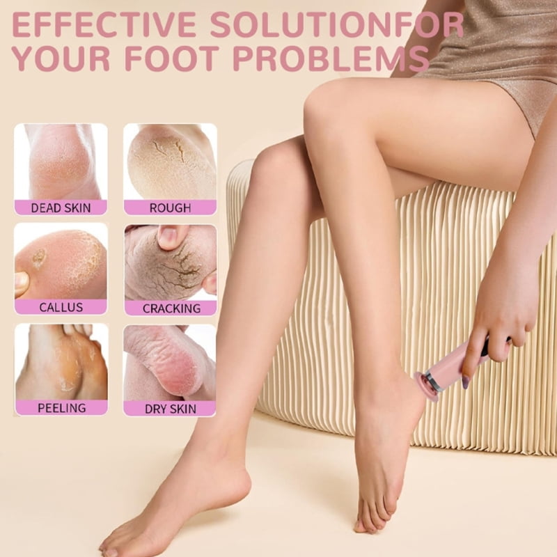 Electric Foot File Callus Remover USB Charging Ergonomic Handle ABS Texture