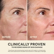 Future Renew Damage Reversal Serum