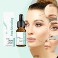 thumbnail image 1 of Fiudx Artículos en oferta con ofertas flash Las esencias acondicionadoras de poros eliminan los puntos negros y suavizan la piel 10 ml, 1 of 7