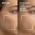 thumbnail image 2 of Exfoliante facial Dr. Brandt Microdermabrasion 60 ml, 2 of 8