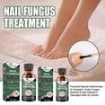 thumbnail image 3 of 2pcs Extra Strength Nail Repair Fluid Toenail And Nail Solution Toenails And Nails Repair Damaged And Discolored Nails new, 3 of 4