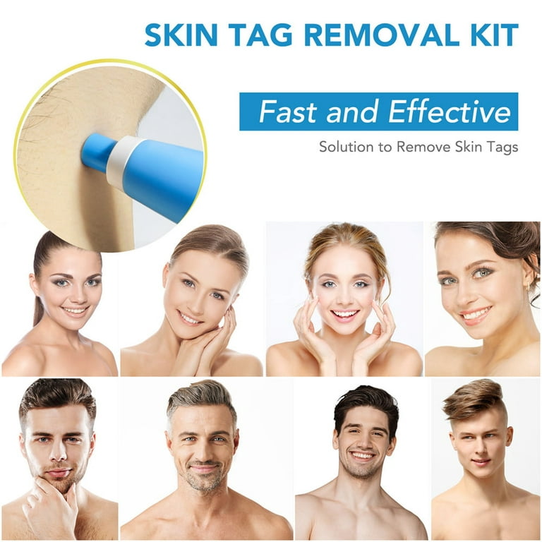 Auto Micro Skin Tag Remover Device Kit Safe Painless Removal 2-8 mm Band  Tool