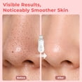 thumbnail image 4 of YEVYO Skin Scrubber Face Spatula, Ultrasonic Skin Scrubber for Deep Cleansing and Blackhead Removal, Facial Spatula, Pore Cleaner at Home and Travel, 4 of 7