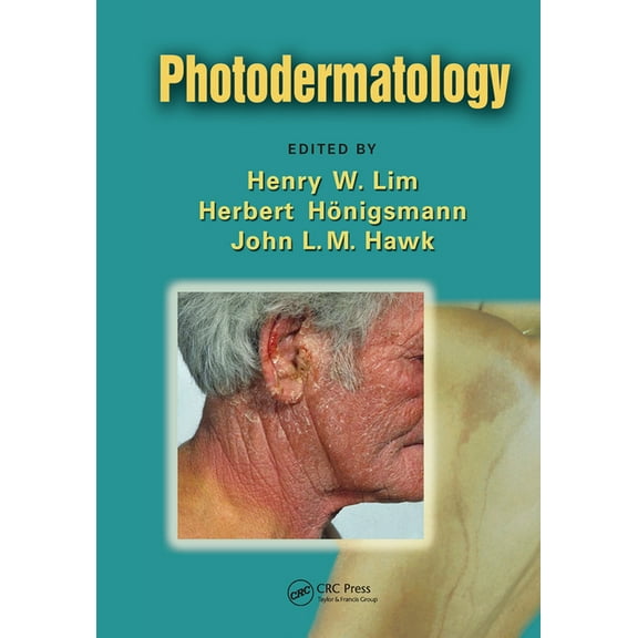 Photodermatology, (Paperback)