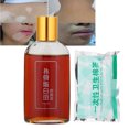 thumbnail image 4 of Vitiligo Treatment Profitable Prevailing Neoteric Strong Compatibility  for Outdoor ANGGREK Otros, 4 of 8