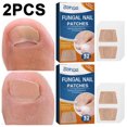 thumbnail image 1 of 32PCS Corrector Pedicure Tool Parches Uñas Transpirables Elástico para Los Tamaños Uñas, 1 of 8