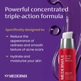thumbnail image 4 of Mederma Acne Scar Serum – Triple-Action Formula with Niacinamide, Tetrapeptide-30, and Polyhydroxy acid – Clinically Shown to Lighten Acne Scars, 1 Fl. Oz., 4 of 10