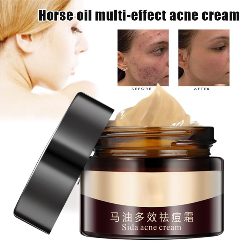 Invisible Acne Spot Treatment Cystic Acne Treatment MessFree Fast