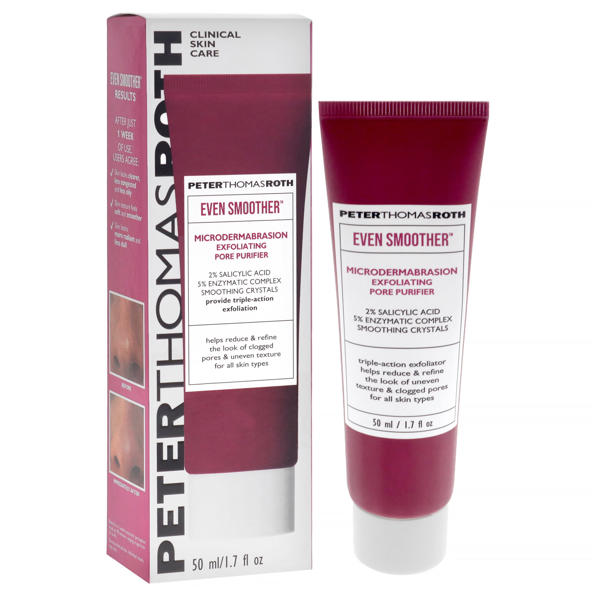 Peter Thomas Roth Even Smoother Microdermabrasion Exfoliating Pore Purifier , 1.7 oz Exfoliator