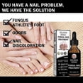 thumbnail image 4 of Nail Repair Liquid Thickening And Bright Nails, Nail Fungus, Dead Sk, 4 of 5