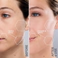 thumbnail image 5 of Beauty Sonicsmooth Dermaplane Razor for Women Face + Eyebrow trimmer Dermaplaning System - Peach Fuzz Remover - 8 Weeks of Dermaplaning Blades, 5 of 5
