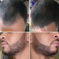 thumbnail image 2 of Bolígrafo para rellenar barba Follicle Booster, impermeable, negro, paquete de 2, 2 of 6