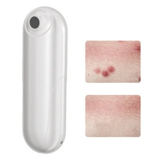 Bug Bite Thing Suction Tool, Poison Remover - Bug Bites and Bee/Wasp  Stings, Natural Insect Bite Relief- White/2 Pack 