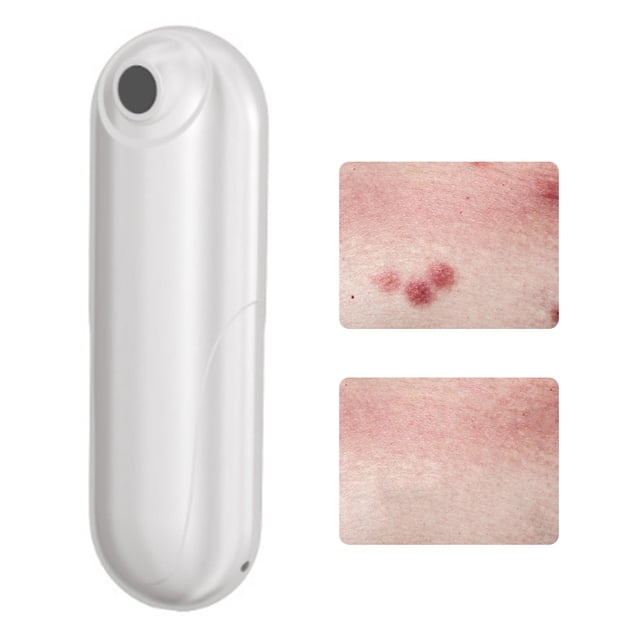 Succionador de Picaduras de Mosquitos Jadeshay Recargable Plateado
