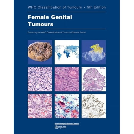 UPC: 9789283245049 | WHO Classification of Tumours: Female Genital Tumours: Who Classification of Tumours (Paperback)