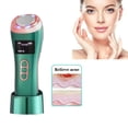 thumbnail image 1 of 4 in 1 Skin Therapy Wand - Ion Therapy LED Light Machine - Anti Aging - Lift & Firm Tighten Skin Wrinkles, 1 of 9