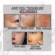 thumbnail image 3 of 2024 New Collagen Boost Anti-aging Serum, Collagen Boost Anti-aging Serum, Collagen B, 3 of 5