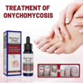 thumbnail image 4 of EELHOE 3 Boxes 50ml Nail Repair Solution Cuticle Revitalizing Nail Hydrating Care Liquid CNO.16663, 4 of 5