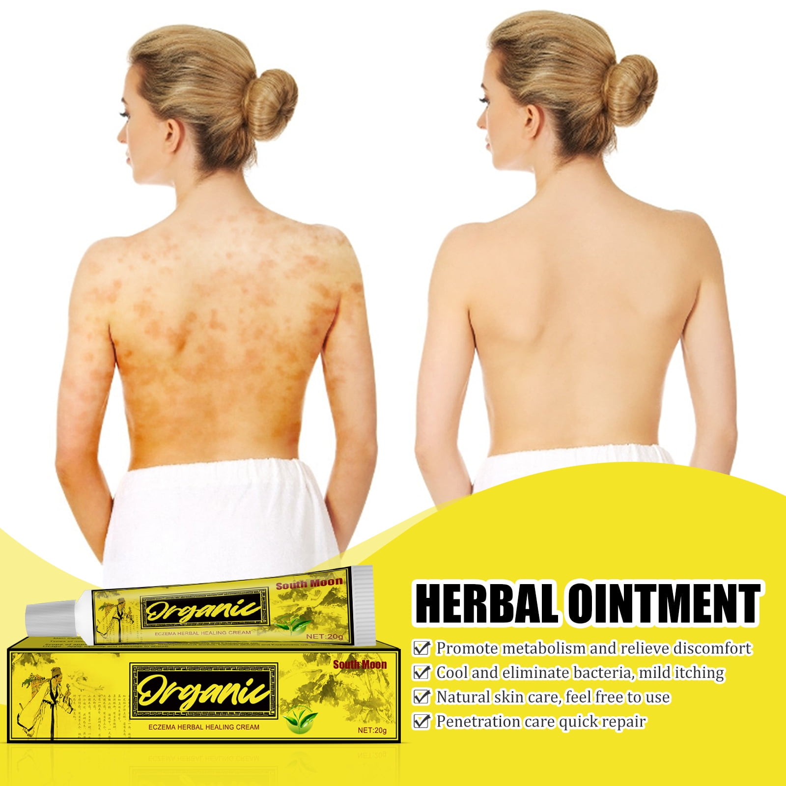 Buy Ringworm Cream Treats Stubborn Ringworm Infections, Fights