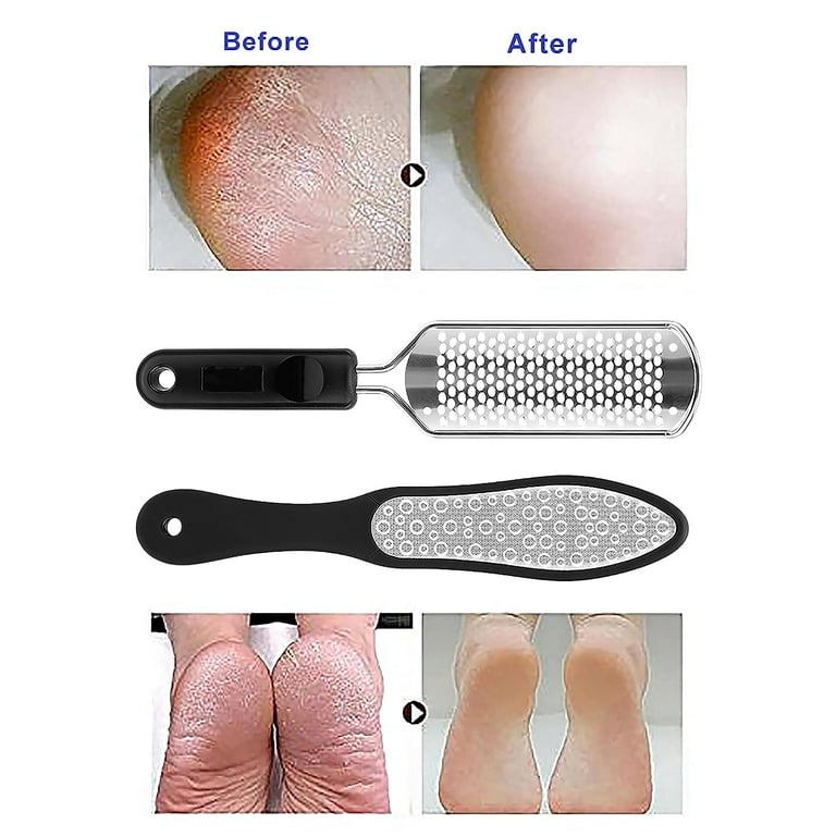 2PCS/Set Professional Pedicure Rasp Foot File Cracked Skin Corns Callus  Remover for Extra Smooth and Beauty Foot 