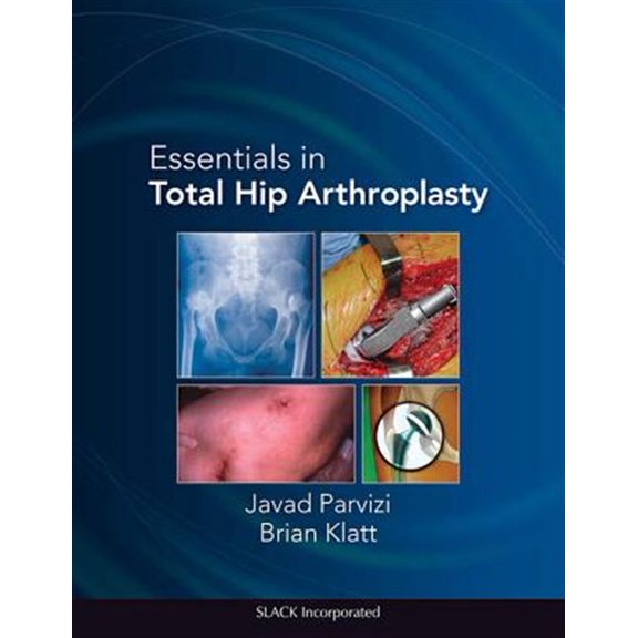 Pre-Owned Essentials in Total Hip Arthroplasty (Hardcover)