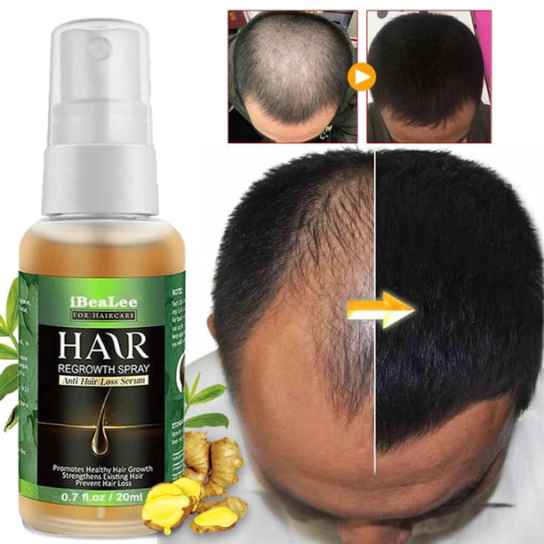 Suero para el cuidado del cabello de 20 ml, suero para el cabello de crecimiento rápido de jengibre eficaz, productos para el cuidado del cabello Ygjytge Cuidado Belleza