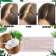 thumbnail image 1 of Aceite de coco anticaída de 30 ml, esencia natural para el crecimiento del cabello para el cuidado de las mujeres y los hombres Likrtyny Cuidado Belleza, 1 of 9