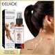 thumbnail image 2 of 30ml Vitiligo Skin Repair Spray For Skin Care, Repair Skin, Vitiligo Care Spray for Reduce White Spots, 2 of 5