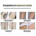 thumbnail image 2 of Ipl Laser Hair Removal Handset Permanent Laser Hair Removal At Home Permanent Hair Removal For Women And Men, 2 of 5