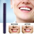 thumbnail image 4 of Sokhug Tooth Cleaning & Beautifying Pen Whitening Gel Pen for Daily Teeth Care & Stain Removal 2ml, 4 of 5