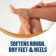 thumbnail image 4 of Crema para pies Gold Bond Suavizante con manteca de karité 120 ml, 4 of 8