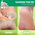 thumbnail image 5 of Crema reparadora para pies Miracle of Aloe 120 ml (paquete de 2), 5 of 5