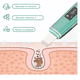 thumbnail image 4 of Limpiador Facial Skin Scrubber Peeling Ultrasónico Portátil Verde, 4 of 5