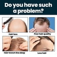 thumbnail image 4 of East Moon Men's Hair Care Serum Men's Hair Cuidado nutricional Esencia hidratante, 4 of 10