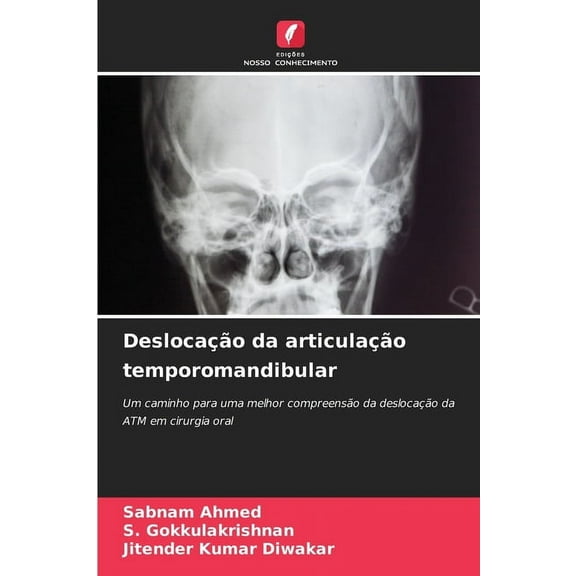 DeslocaÃ§Ã£o da articulaÃ§Ã£o temporomandibular, (Paperback)
